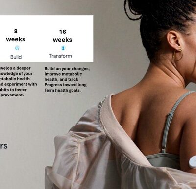 continuous glucose monitor