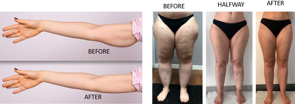 dislipidemia visual journey healing